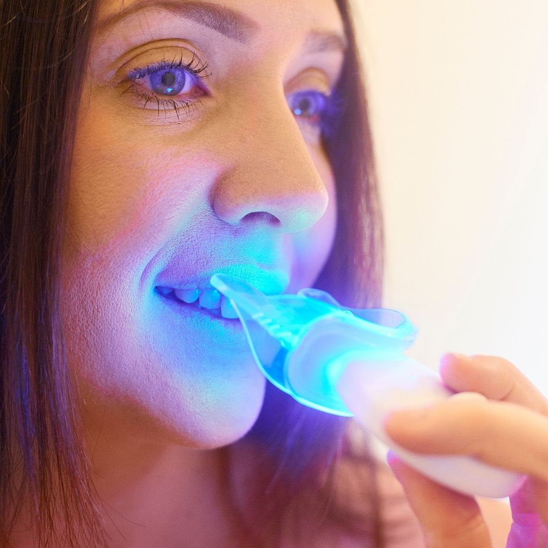 teeth whitening kit